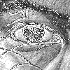 My Eye2