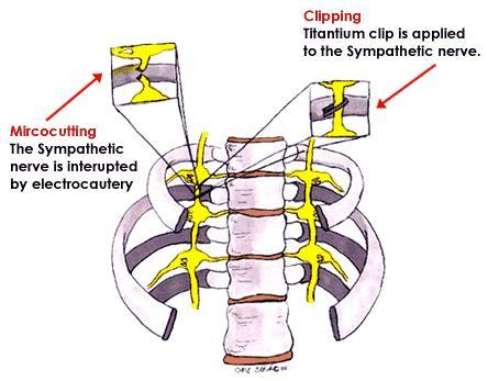 Clipping, técnica inventada por un doctor asiático