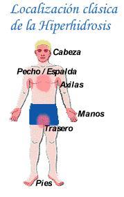 Localizacin de la Hiperhidrosis