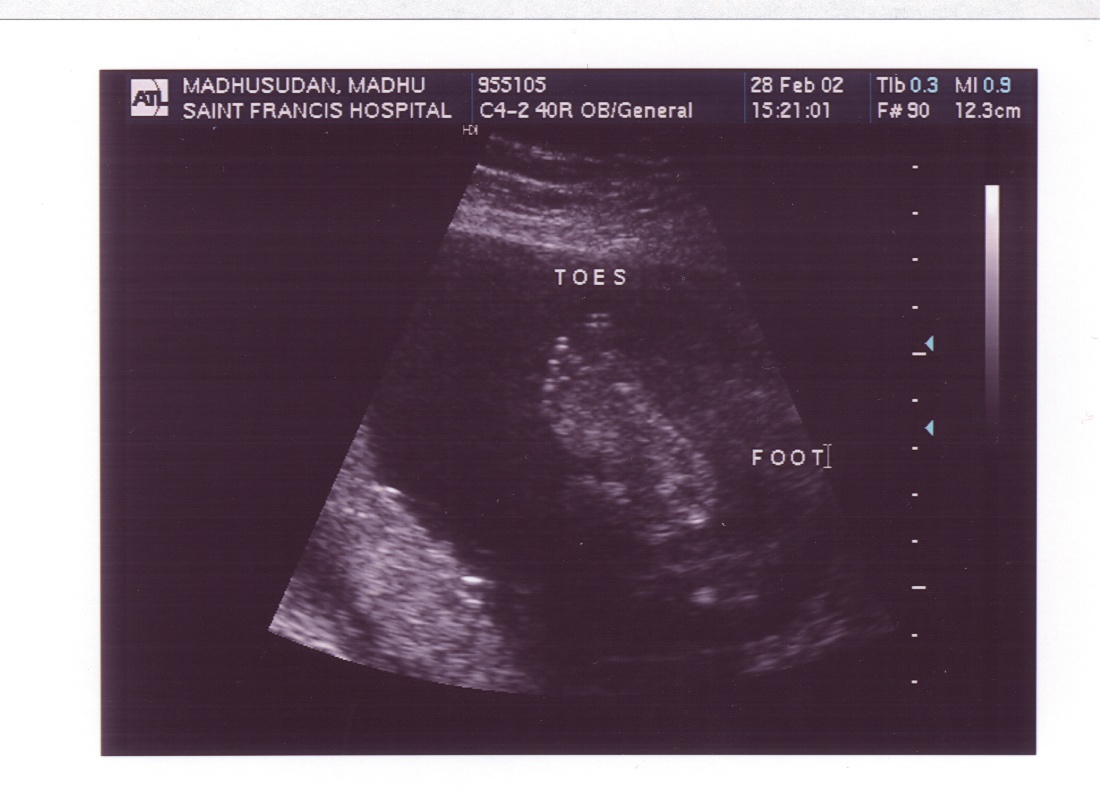 One more!!! Showing his foot..