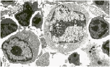 T-cell size correlates with activation state. Small are resting, Large are very active and may divide, and Intermediate are highly motile transitional forms
