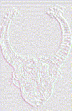 unsiglode
