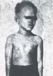 ectodermal.jpg (20582 bytes)