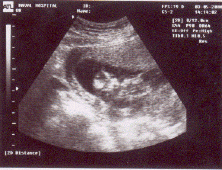 Baby2.gif (100951 bytes)