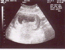 Baby3.gif (92405 bytes)