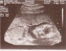 Baby5.gif (97431 bytes)