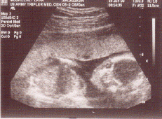 Baby6.gif (96505 bytes)