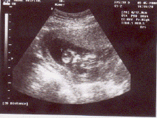 Baby.gif (98916 bytes)